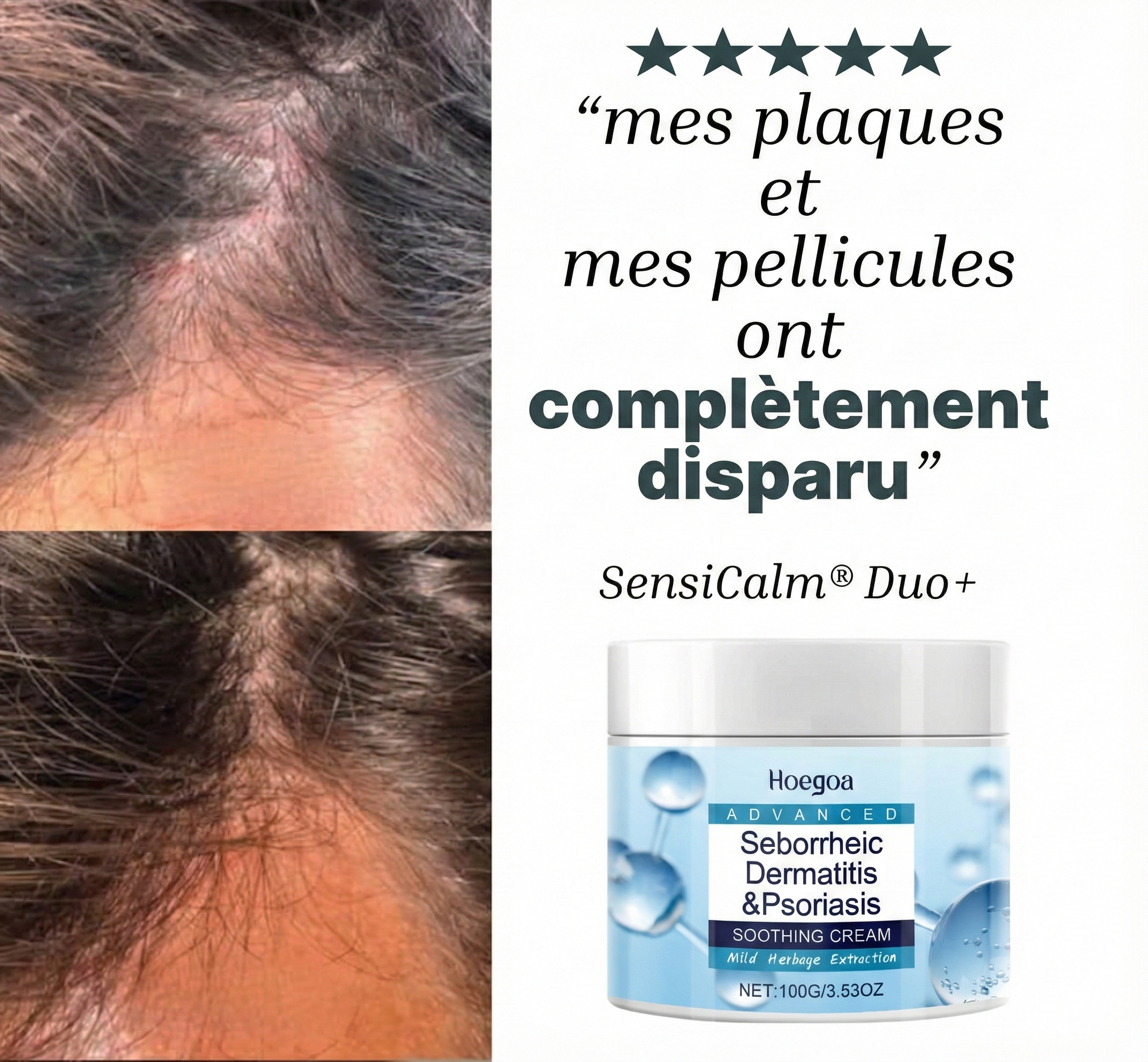 Crème Hoegoa | Pour un cuir chevelu et une peau douce et apaisées